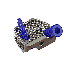 3D打印獨立固定融合器(qì)